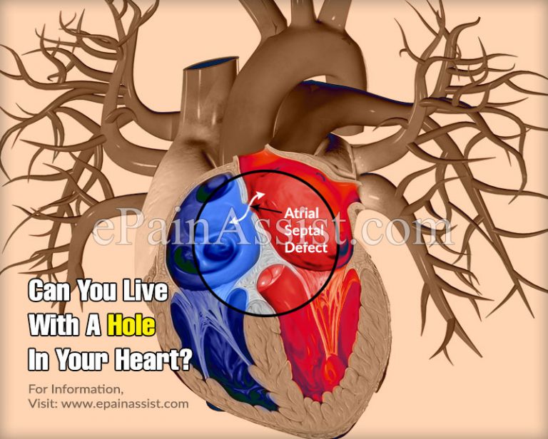 Can You Live With A Hole In Your Heart?