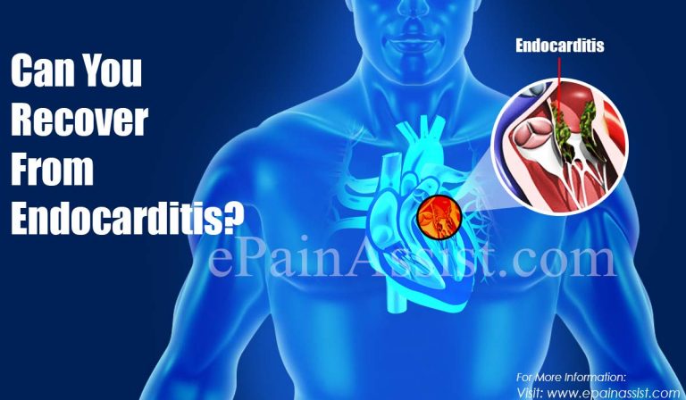Can You Recover From Endocarditis?