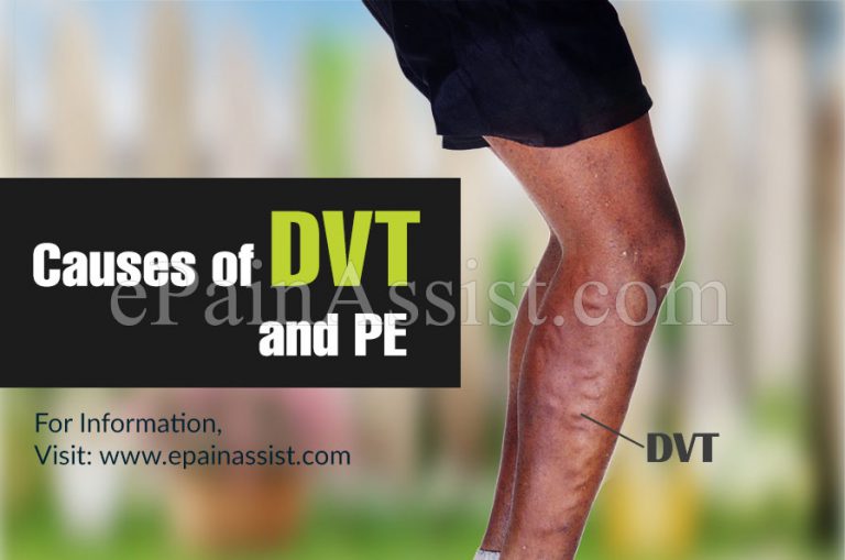 Causes of DVT and PE & its Symptoms, Diagnosis