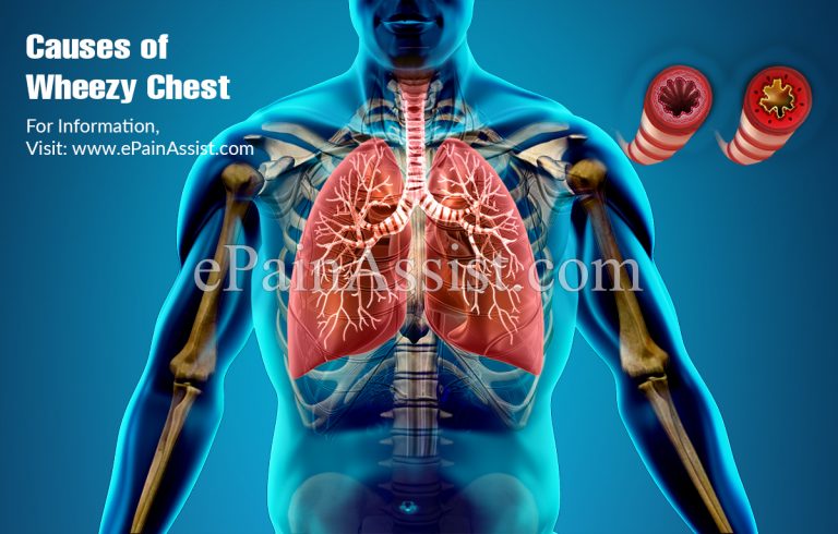 Causes of Wheezy Chest & Its Treatment, Home Remedies