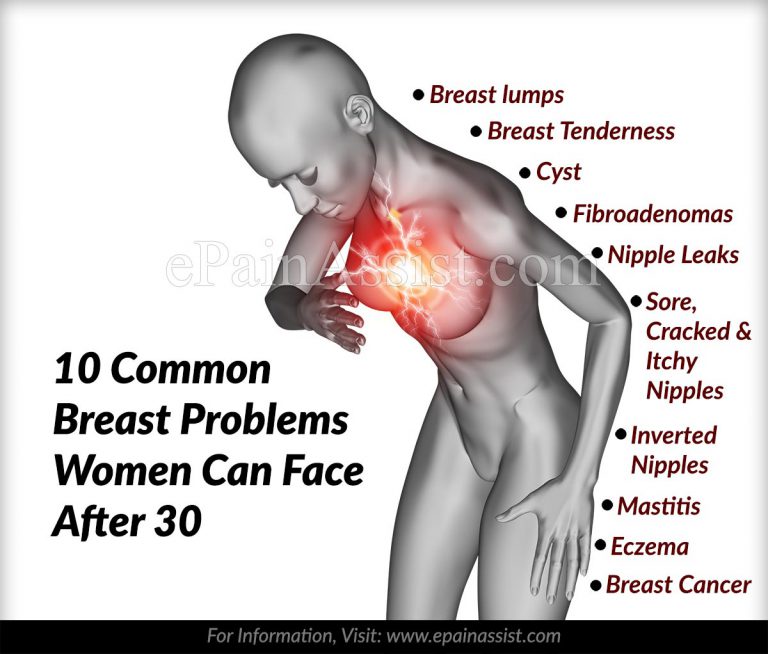 10 Common Breast Problems Women Can Face After 30