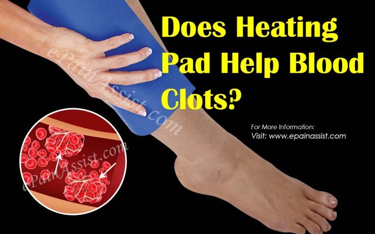 Does Heating Pad Help Blood Clots?