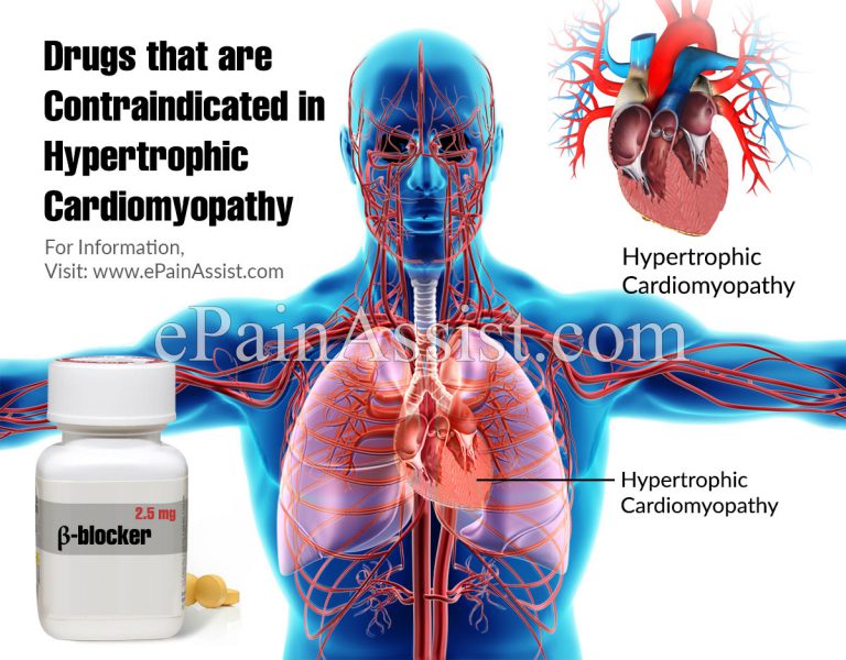 Drugs that are Contraindicated in Hypertrophic Cardiomyopathy