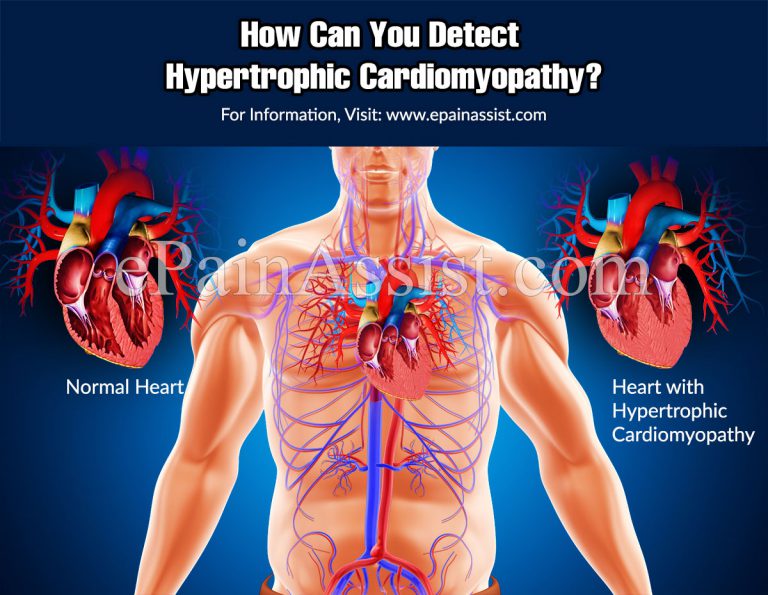 How Can You Detect Hypertrophic Cardiomyopathy?