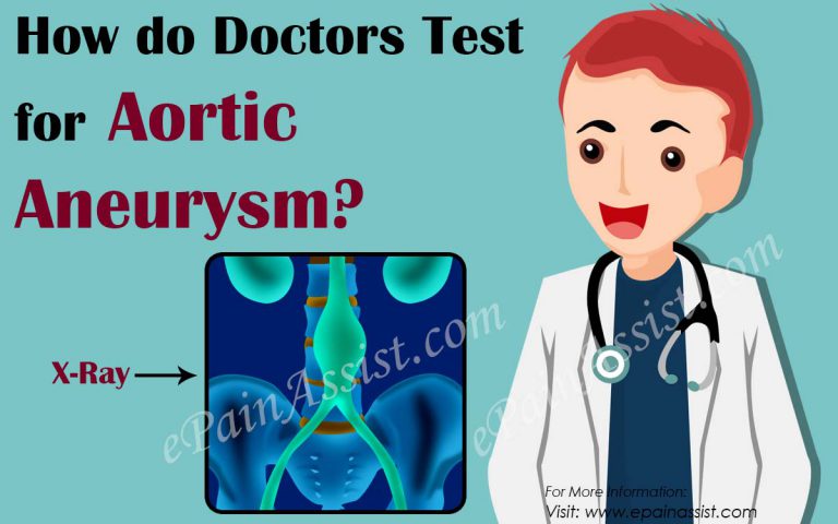 How do Doctors Test for Aortic Aneurysm?