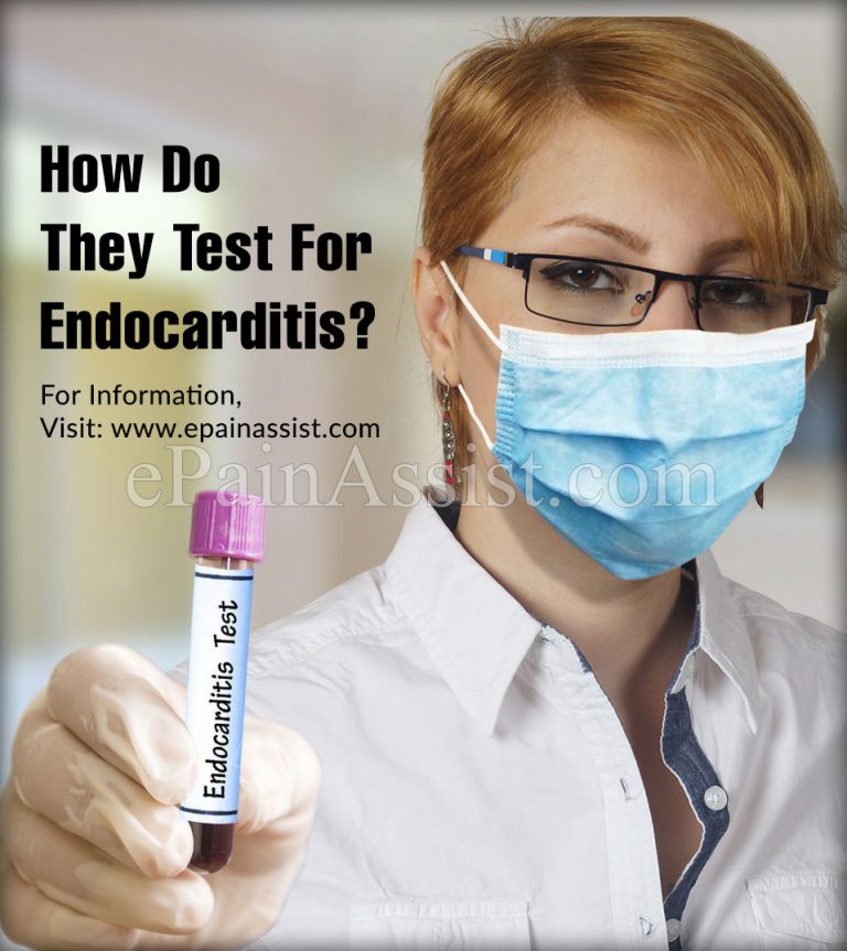 How Do They Test For Endocarditis?