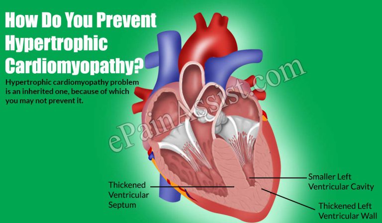 How Do You Prevent Hypertrophic Cardiomyopathy?