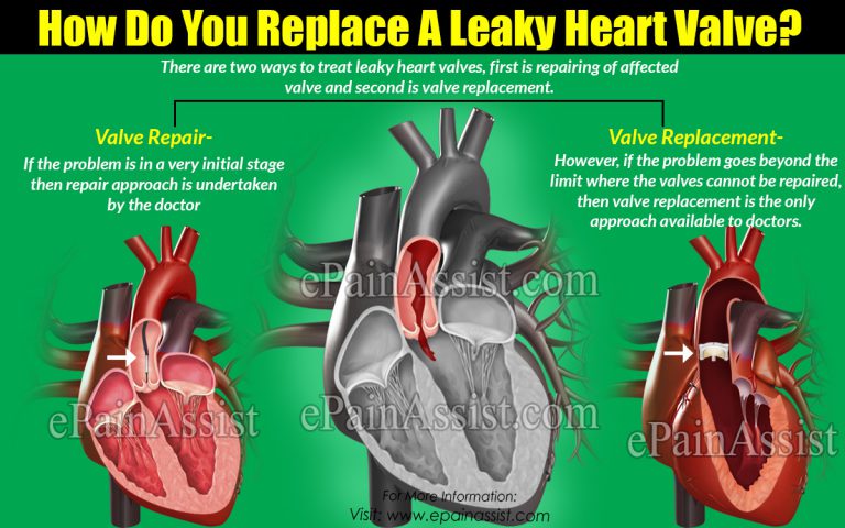 How Do You Replace A Leaky Heart Valve?