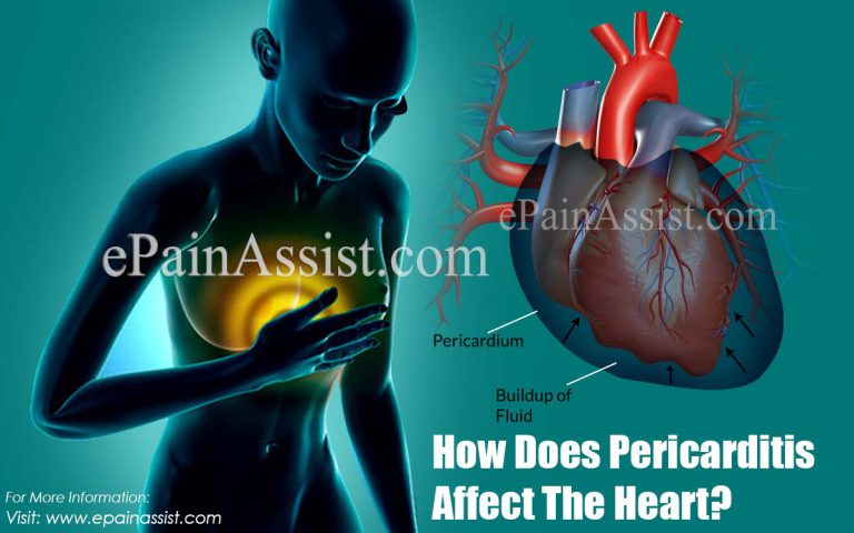 How Does Pericarditis Affect The Heart?
