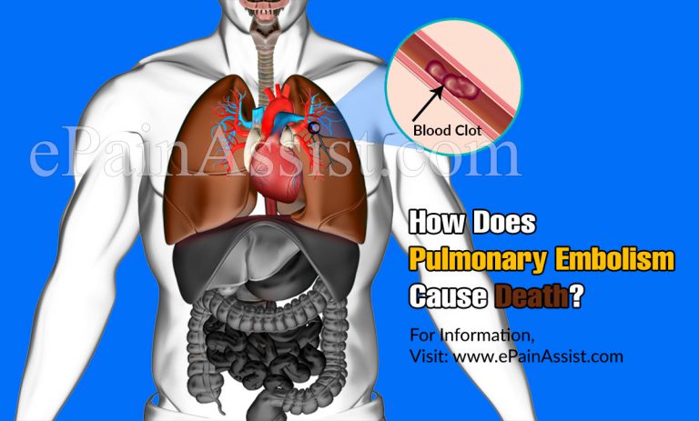 How Does Pulmonary Embolism Cause Death?
