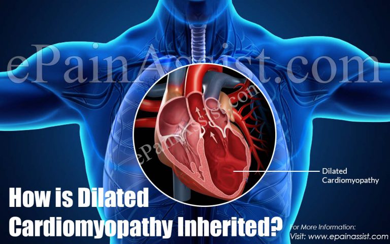 How is Dilated Cardiomyopathy Inherited?