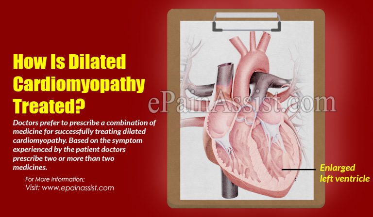 How Is Dilated Cardiomyopathy Treated?