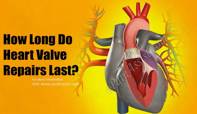 How Long Do Heart Valve Repairs Last?