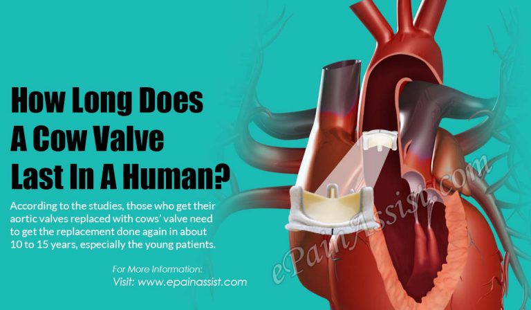 How Long Does A Cow Valve Last In A Human?