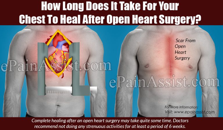 How Long Does It Take For Your Chest To Heal After Open Heart Surgery?