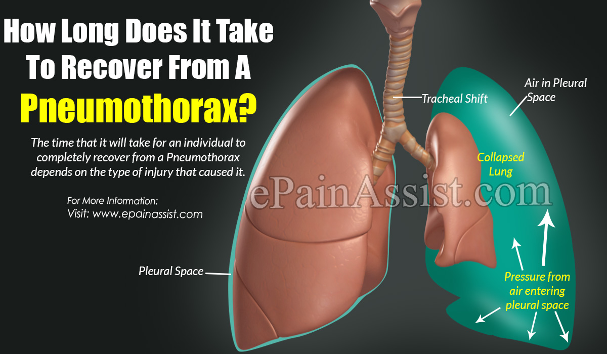 How Long Does It Take To Recover From A Pneumothorax?