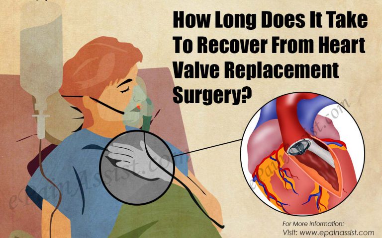 How Long Does It Take To Recover From Heart Valve Replacement Surgery?