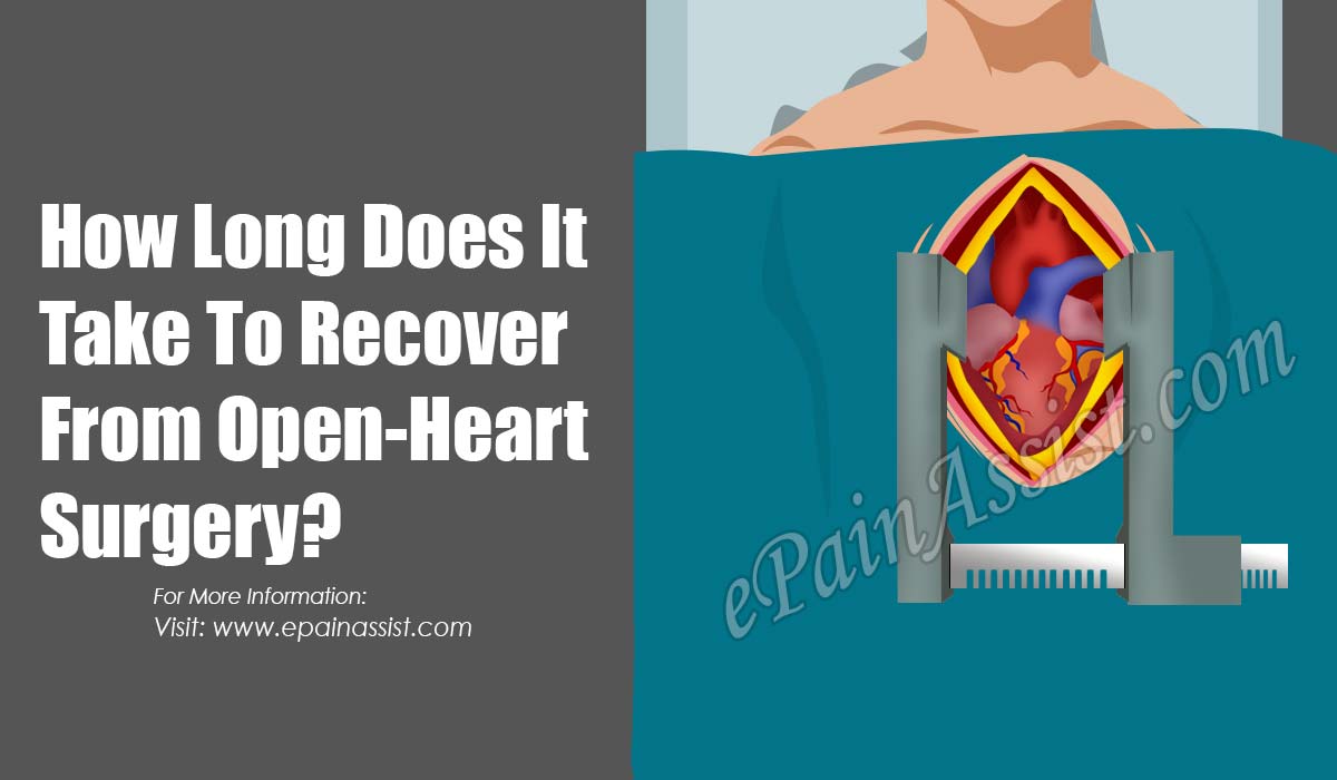 How Long Does It Take To Recover From Open-Heart Surgery?