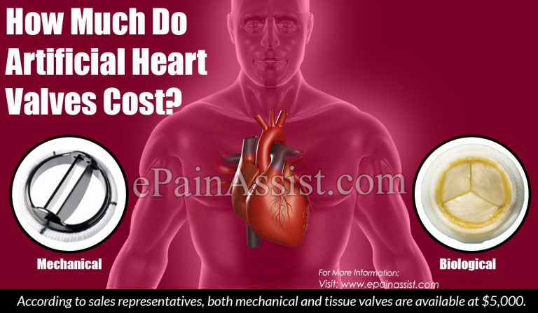 How Much Do Artificial Heart Valves Cost?