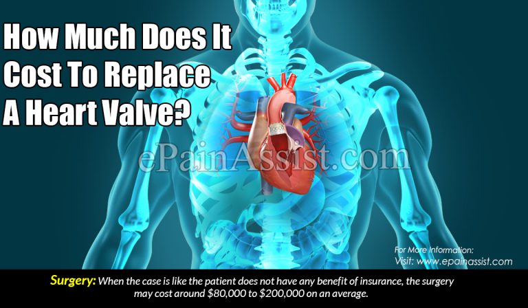 How Much Does It Cost To Replace A Heart Valve?