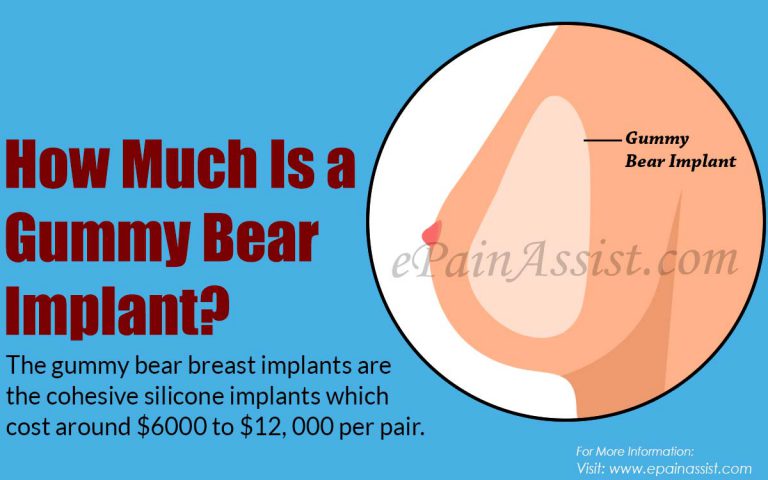 How Much Is a Gummy Bear Implant?