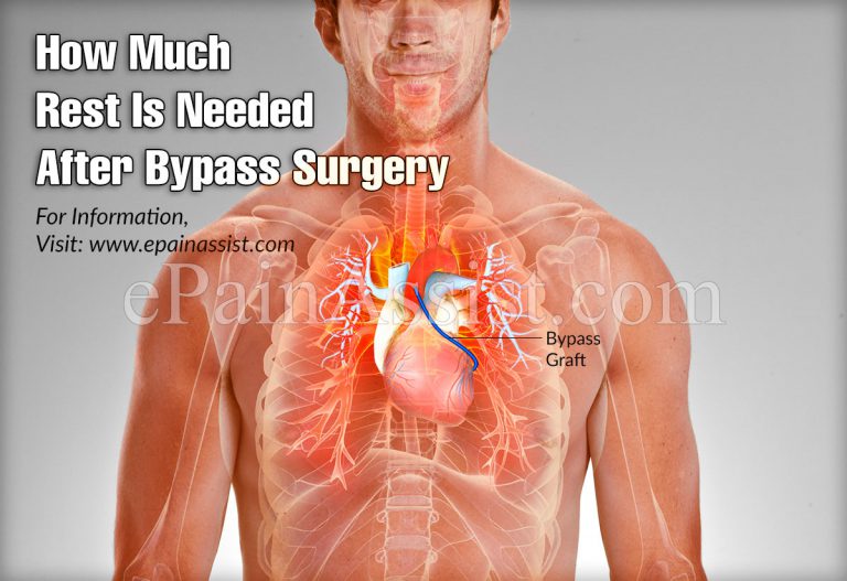 How Much Rest Is Needed After Bypass Surgery?