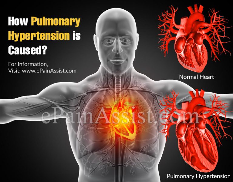 How Pulmonary Hypertension is Caused?