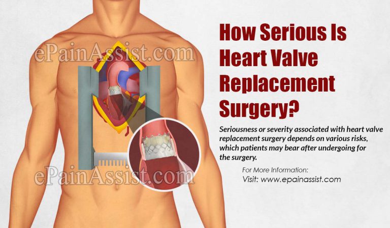 How Serious Is Heart Valve Replacement Surgery?