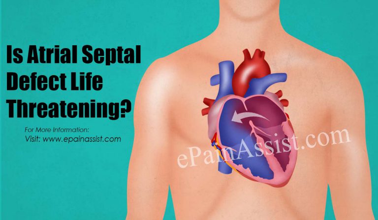 Is Atrial Septal Defect Life Threatening?