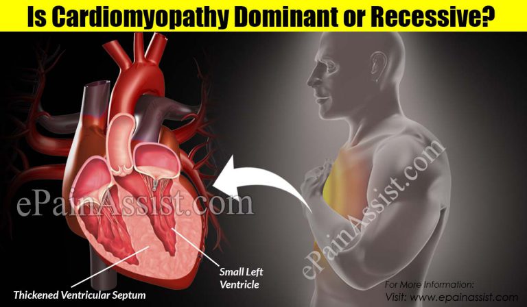 Is Cardiomyopathy Dominant or Recessive?