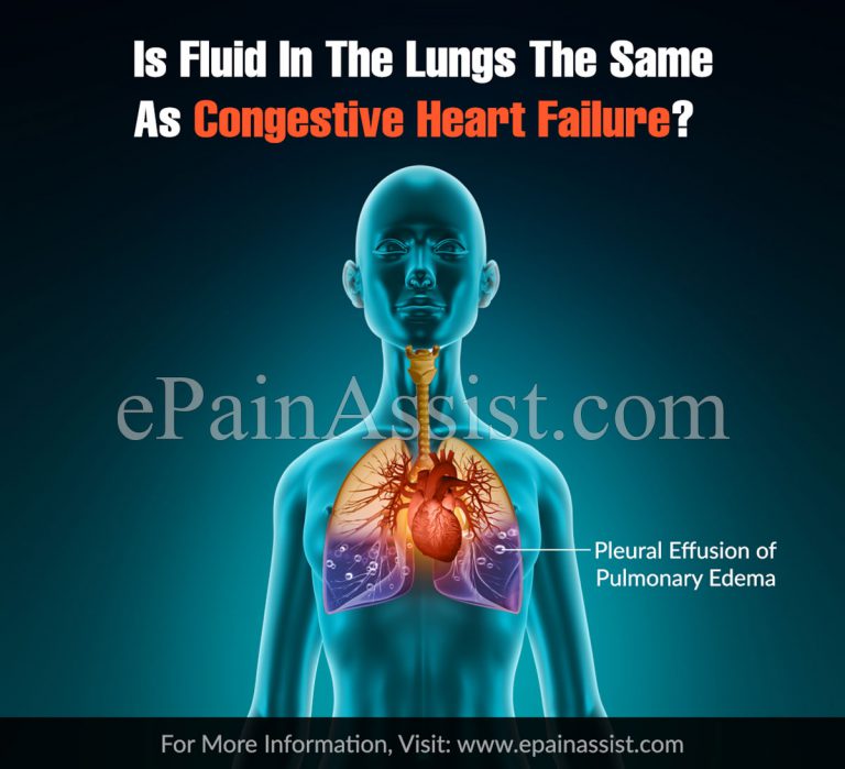 Is Fluid In The Lungs The Same As Congestive Heart Failure?