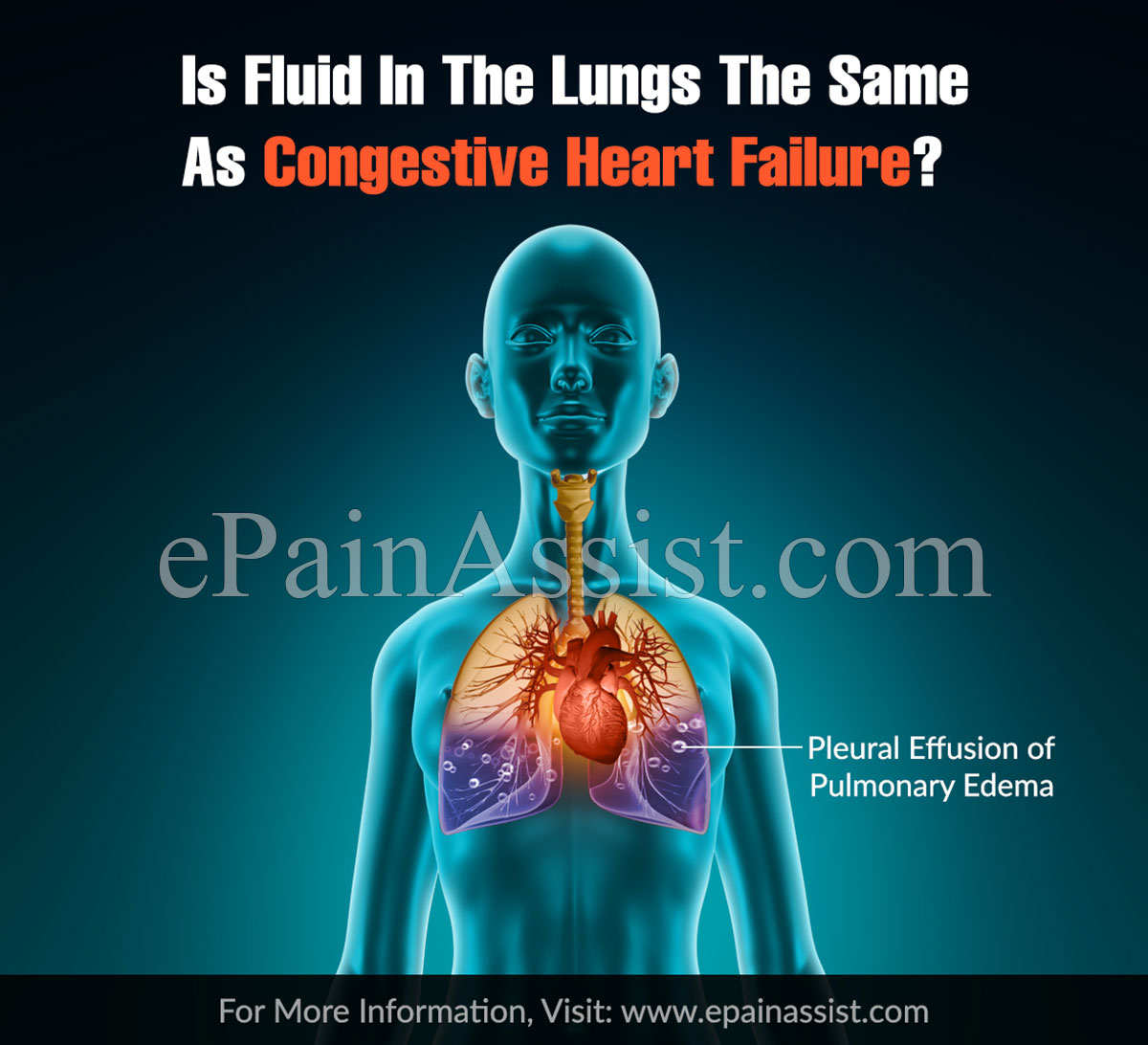 Is Fluid In The Lungs The Same As Congestive Heart Failure?