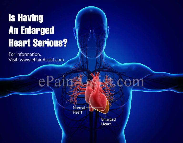 Is Having An Enlarged Heart Serious & Can An Enlarged Heart Be Reversed?