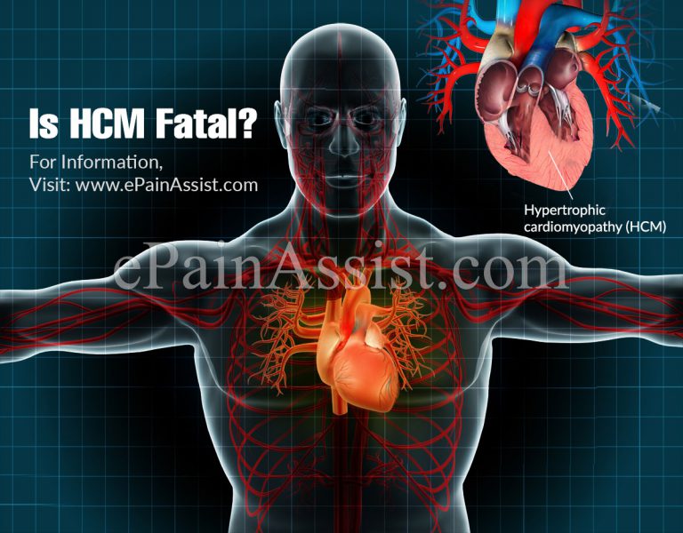 Is HCM Fatal?