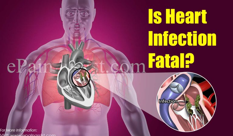 Is Heart Infection Fatal?