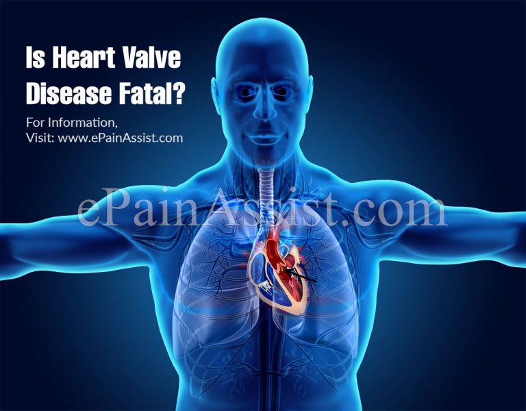 Is Heart Valve Disease Fatal?