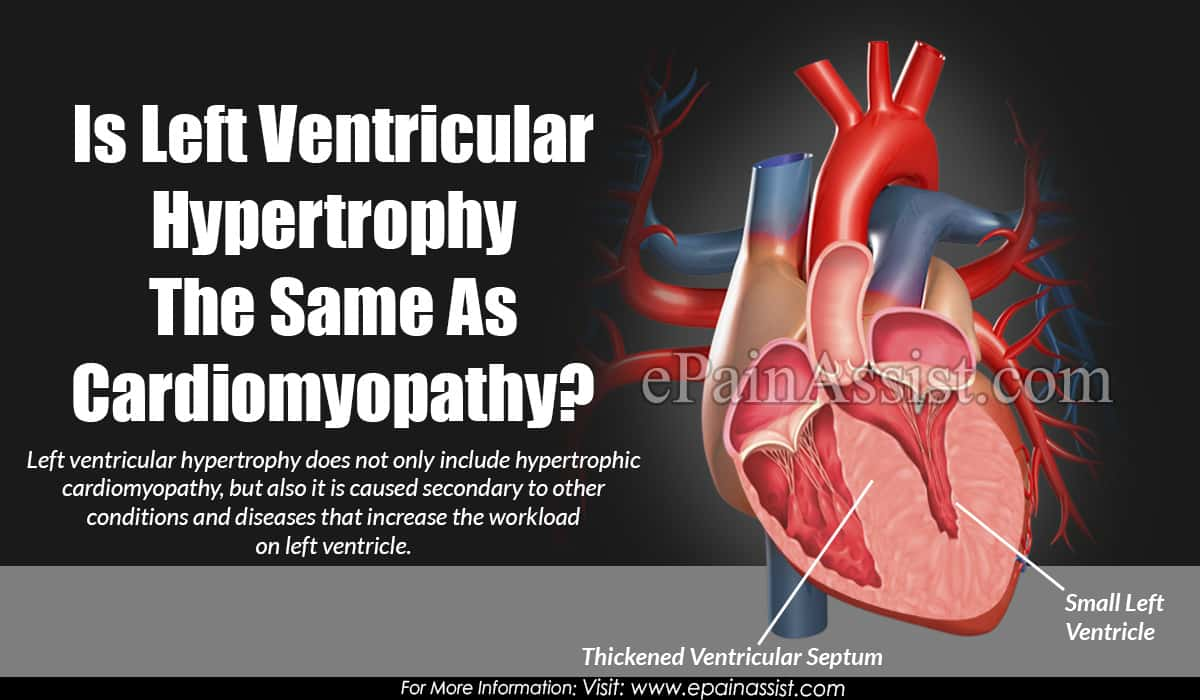 Is Left Ventricular Hypertrophy The Same As Cardiomyopathy?