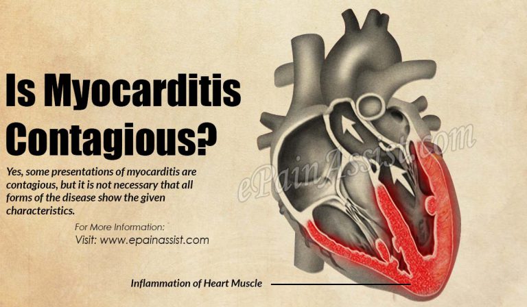 Is Myocarditis Contagious?