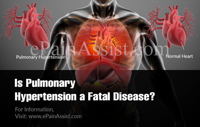 Is Pulmonary Hypertension A Fatal Disease?