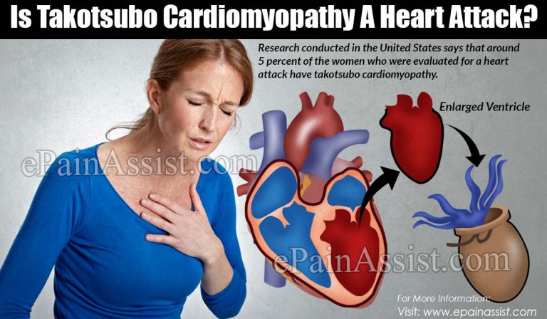 Is Takotsubo Cardiomyopathy A Heart Attack?