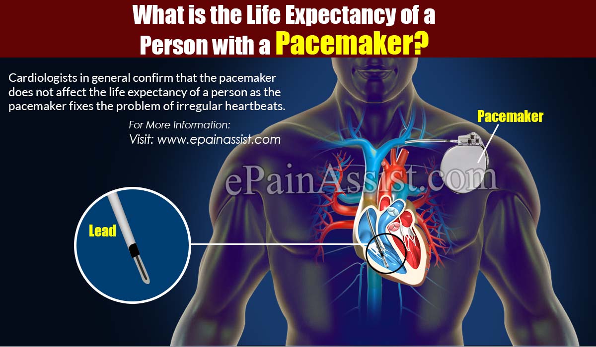 What is the Life Expectancy of a Person with a Pacemaker?