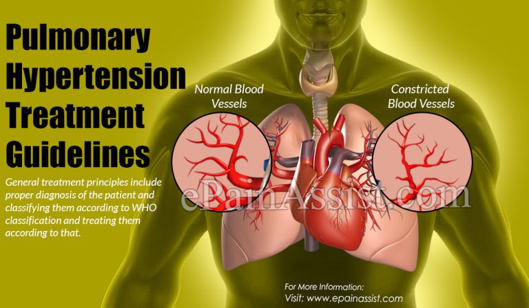 Pulmonary Hypertension Treatment Guidelines