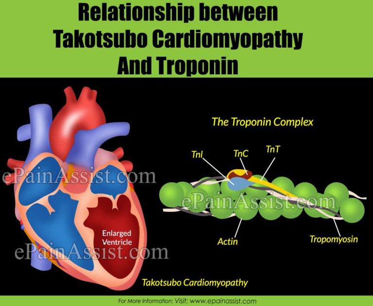Relationship between Takotsubo Cardiomyopathy and Troponin