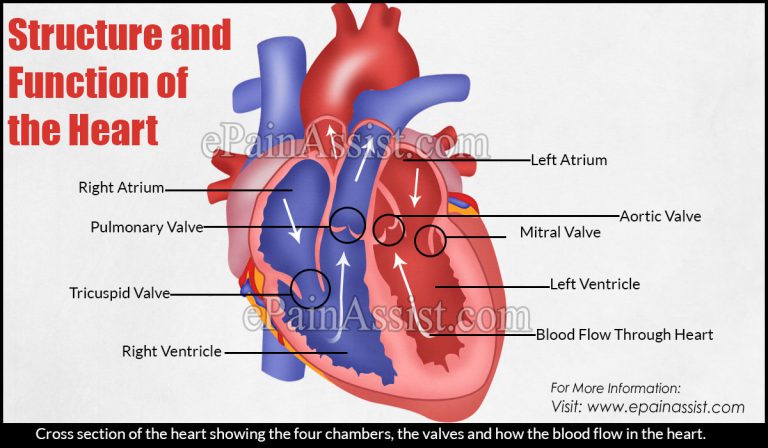 Is Left Ventricular Hypertrophy a Heart Attack?