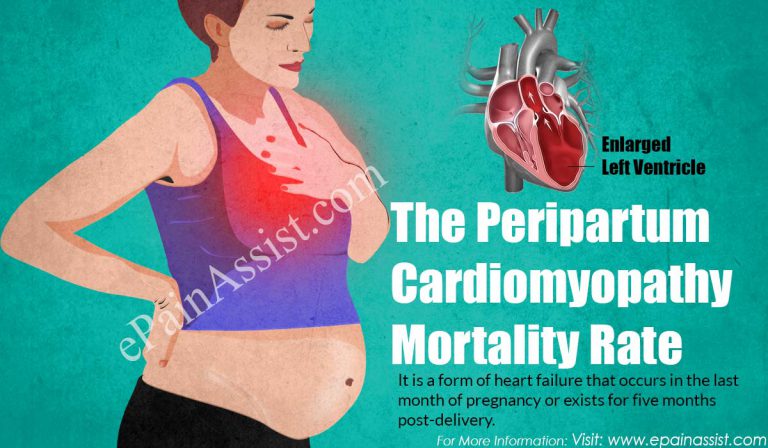 The Peripartum Cardiomyopathy Mortality Rate