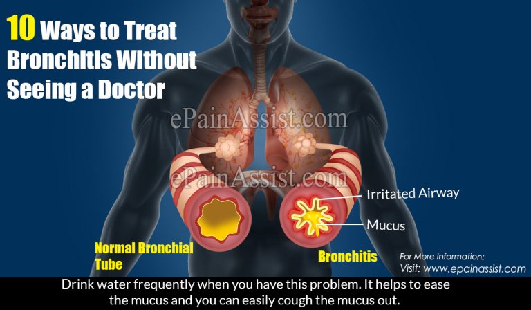10 Ways to Treat Bronchitis Without Seeing a Doctor