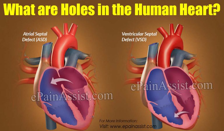 What are Holes in the Human Heart?