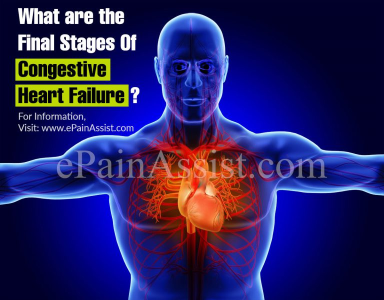 What are the Final Stages Of Congestive Heart Failure?
