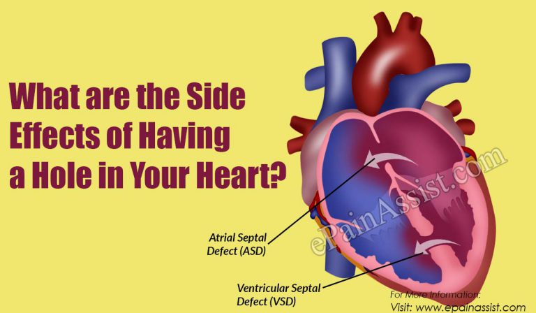 What are the Side Effects of Having a Hole in Your Heart?