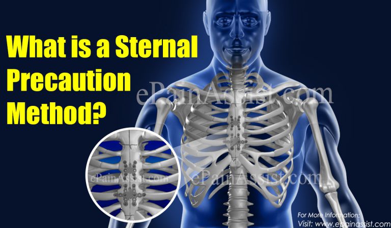 What are the Standard Sternal Precautions?